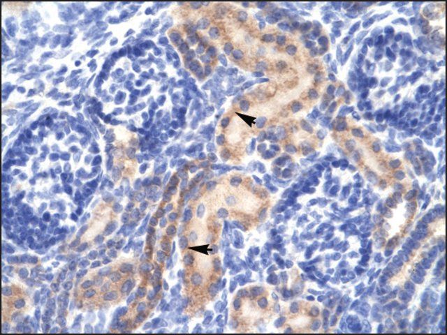 Anti-PCK1 (AB2) antibody produced in rabbit