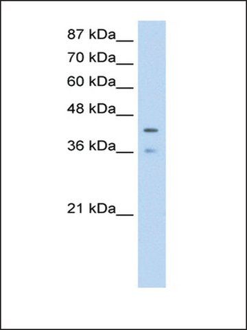 Anti-PCBP4 (AB2) antibody produced in rabbit