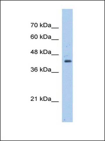 Anti-GNAS (AB1) antibody produced in rabbit