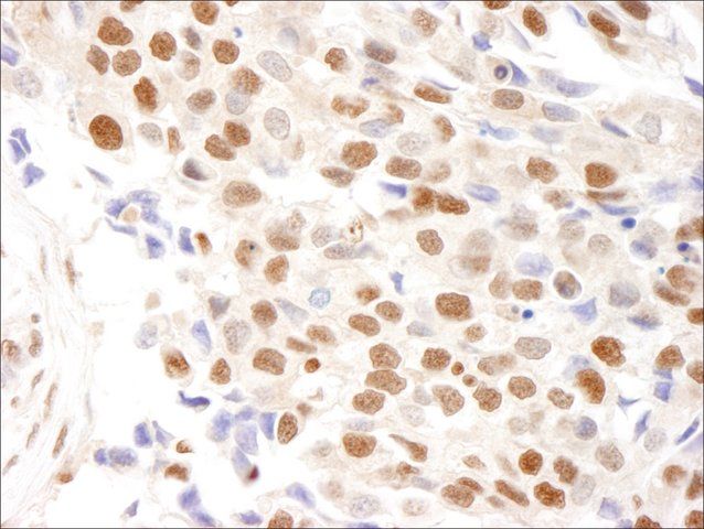 Rabbit anti-RPA32 Antibody, Affinity Purified