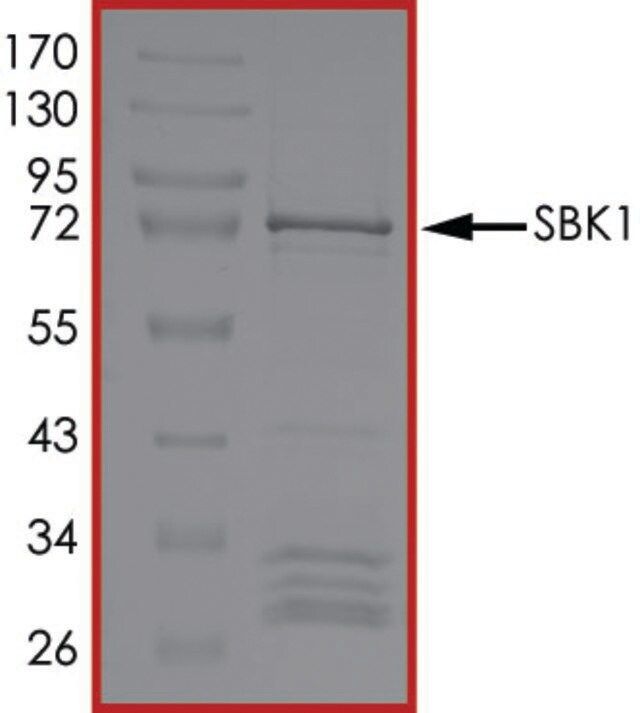 SBK1, Active