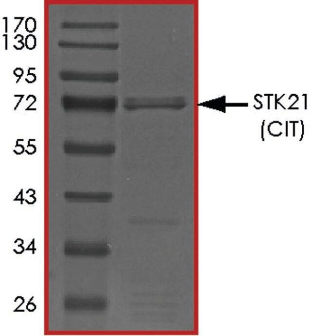 STK21 (CIT), Active