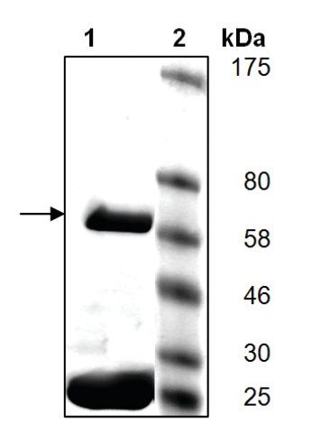 PARP5A active human