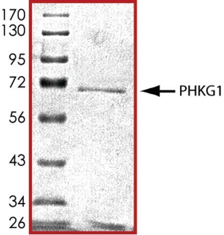 PHKG1, active, GST tagged human