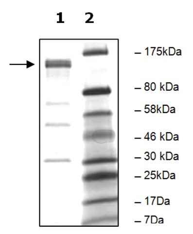 PDE4A10 active human