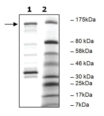 PDE4A4B active human