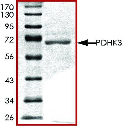 PDHK3, active, GST tagged human