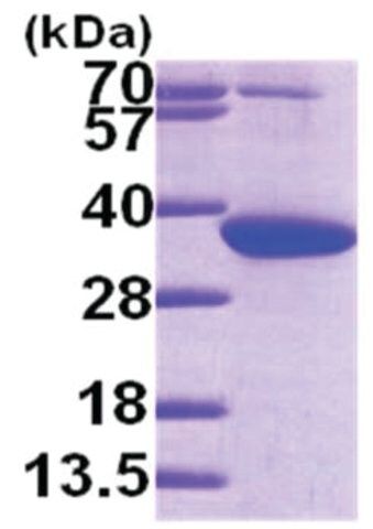 PYCR1 human