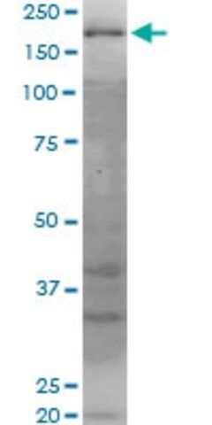 Monoclonal Anti-WRN, (C-terminal) antibody produced in mouse