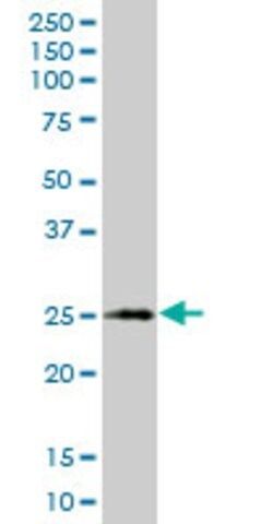 Monoclonal Anti-XBP1 antibody produced in mouse