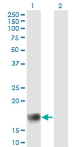 Monoclonal Anti-XAGE2, (C-terminal) antibody produced in mouse