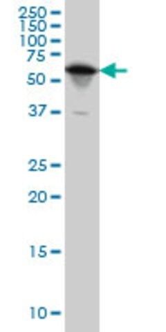 Monoclonal Anti-YARS antibody produced in mouse