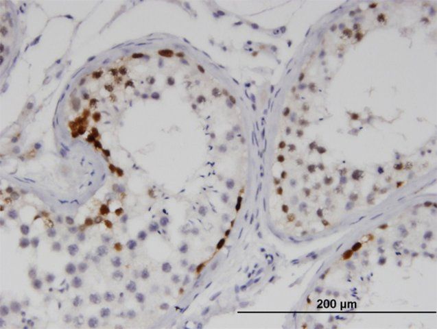 Monoclonal Anti-SSX2 antibody produced in mouse