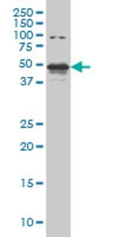 Monoclonal Anti-STK38 antibody produced in mouse