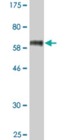 Monoclonal Anti-STEAP1 antibody produced in mouse