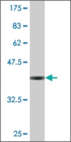 Monoclonal Anti-SURF5, (N-terminal) antibody produced in mouse