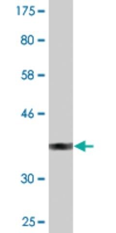 Monoclonal Anti-SUSD5 antibody produced in mouse