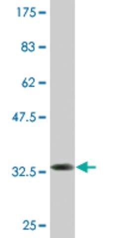 Monoclonal Anti-TIMM8A antibody produced in mouse