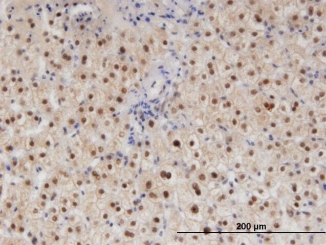 Monoclonal Anti-RAD23B, (C-terminal) antibody produced in mouse