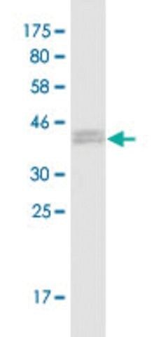 Monoclonal Anti-RABGAP1, (N-terminal) antibody produced in mouse