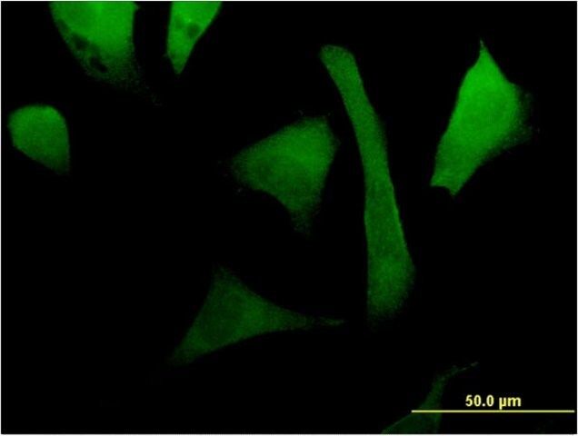 Monoclonal Anti-RAC2 antibody produced in mouse