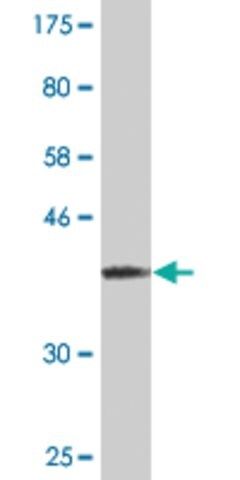 Monoclonal Anti-RPS17 antibody produced in mouse