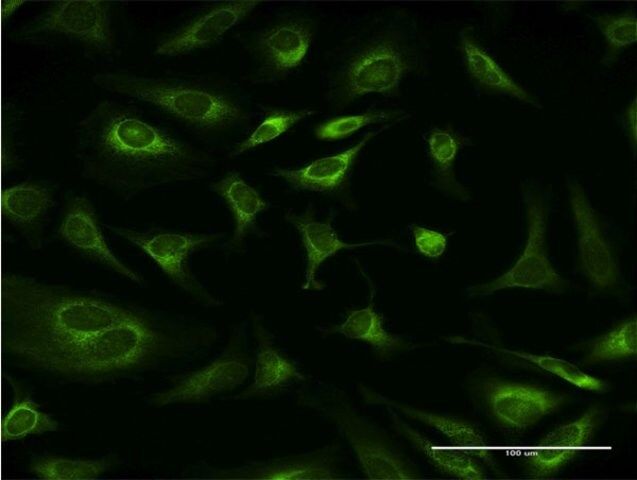 Monoclonal Anti-RPN1, (C-terminal) antibody produced in mouse