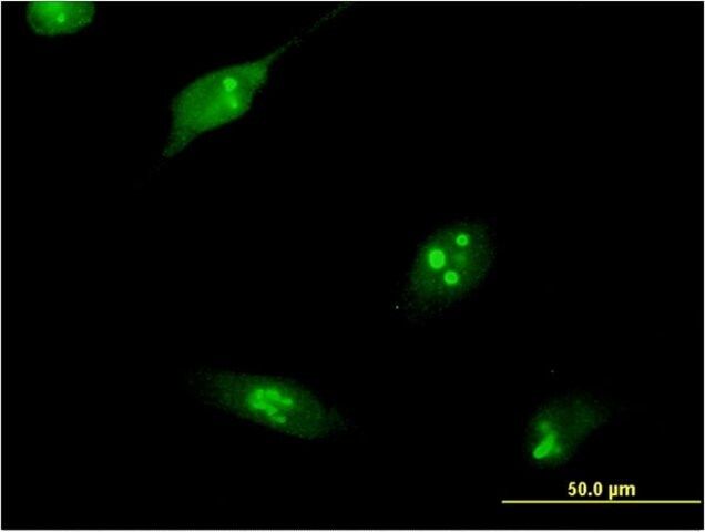 Monoclonal Anti-RPL10L antibody produced in mouse