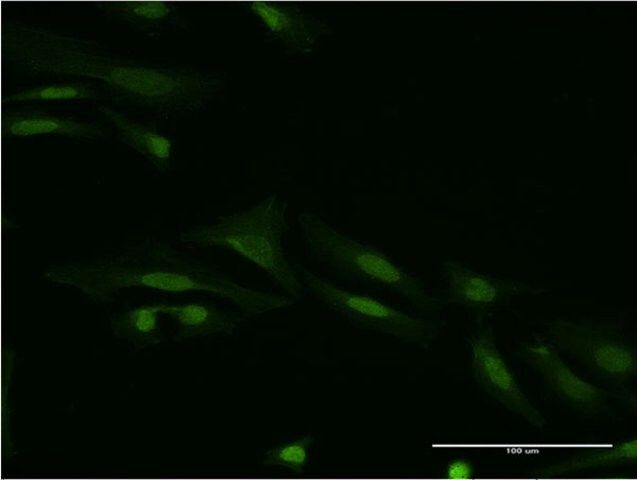 Monoclonal Anti-SMAD9 antibody produced in mouse