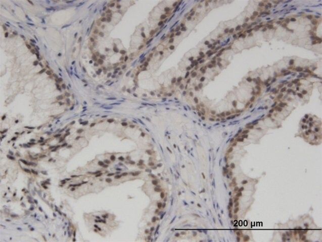 Monoclonal Anti-SMARCA5 antibody produced in mouse