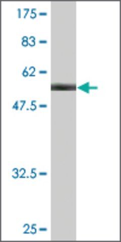 Monoclonal Anti-PKD1L2 antibody produced in mouse