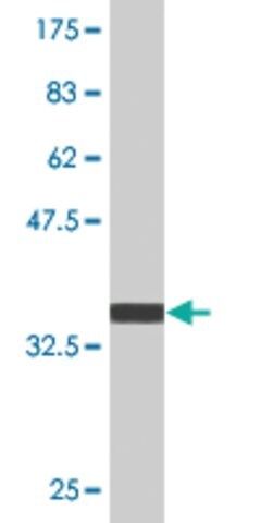 Monoclonal Anti-PIM3, (C-terminal) antibody produced in mouse