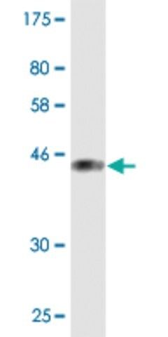 Monoclonal Anti-PIP5K1C, (C-terminal) antibody produced in mouse