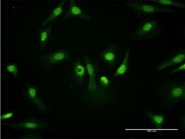 Monoclonal Anti-PKM2, (C-terminal) antibody produced in mouse