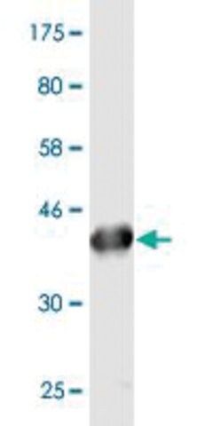 Monoclonal Anti-PLA2G16 antibody produced in mouse