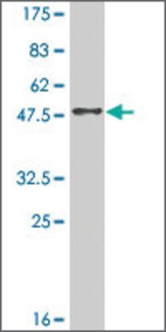 Monoclonal Anti-RAB38 antibody produced in mouse