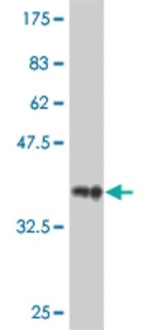 Monoclonal Anti-RAB9A antibody produced in mouse