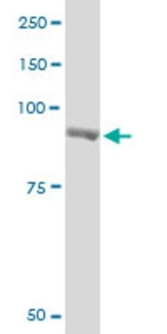 Monoclonal Anti-PYGM antibody produced in mouse