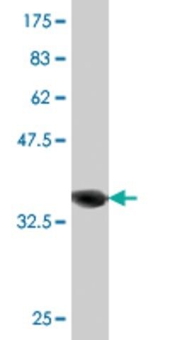 Monoclonal Anti-RAB21, (C-terminal) antibody produced in mouse