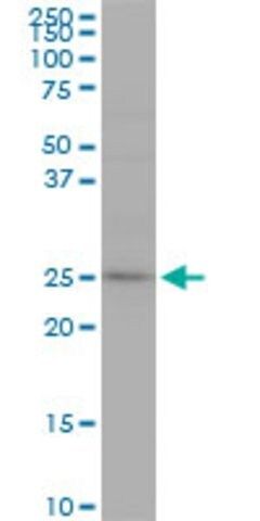 Monoclonal Anti-RAB7L1 antibody produced in mouse