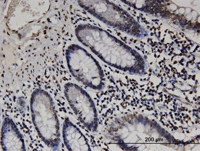 Monoclonal Anti-RABGAP1L antibody produced in mouse