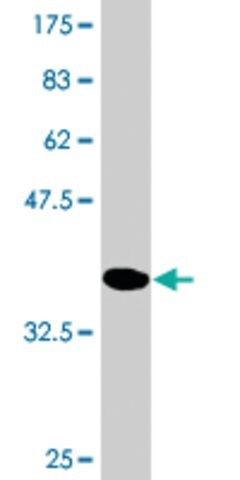 Monoclonal Anti-PYGM, (C-terminal) antibody produced in mouse