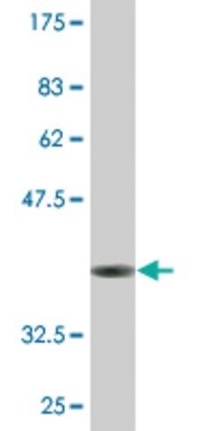 Monoclonal Anti-RAB28 antibody produced in mouse