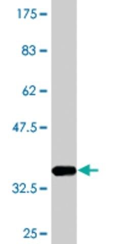 Monoclonal Anti-RABAC1, (N-terminal) antibody produced in mouse