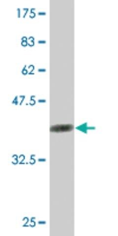 Monoclonal Anti-RABEPK, (C-terminal) antibody produced in mouse