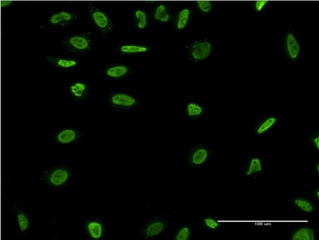 Monoclonal Anti-RAD18 antibody produced in mouse