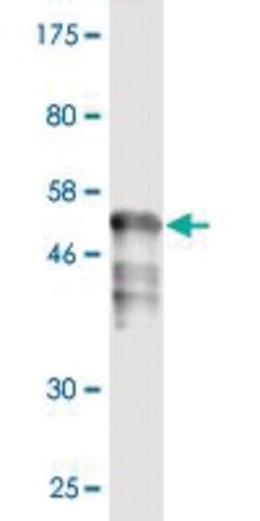 Monoclonal Anti-RAD51 antibody produced in mouse