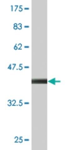 Monoclonal Anti-NHLRC1 antibody produced in mouse