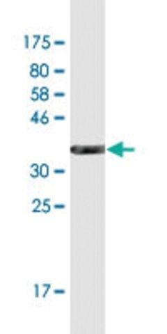 Monoclonal Anti-NPHS1 antibody produced in mouse