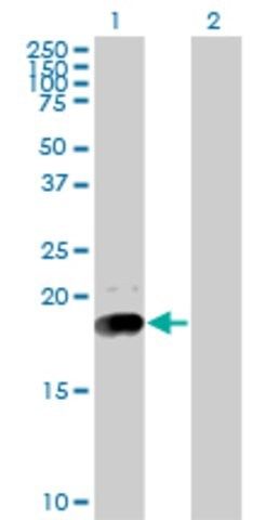 Monoclonal Anti-NPC2 antibody produced in mouse